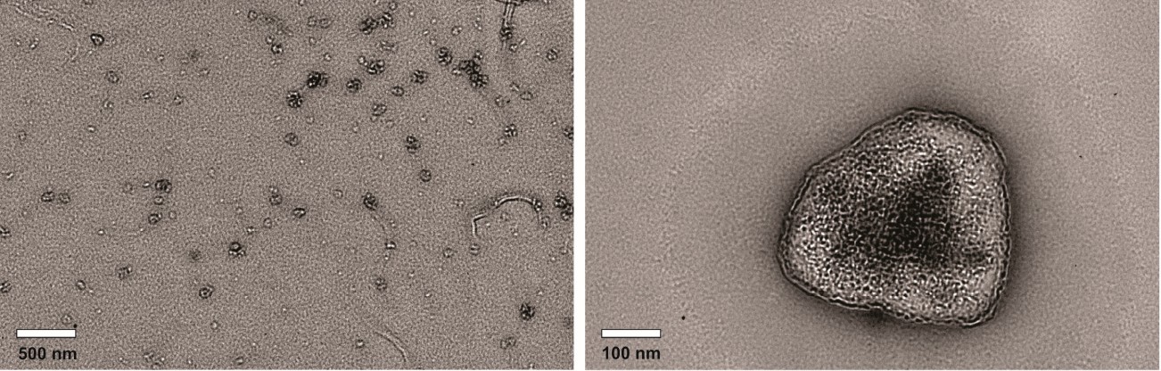 TEM image of blueberry-derived nanovesicles isolated at 40000 g and stained with phosphotungstic acid.